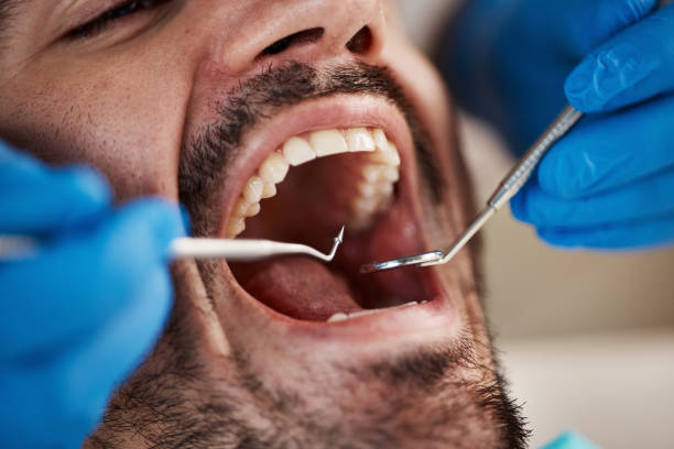 Best Emergency Gum Pain Relief  in Warsaw, MO
